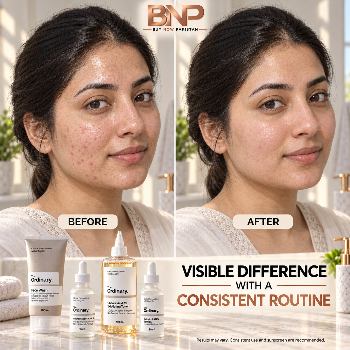 The Ordinary Daily Set — Complete 4-Product Skincare Routine (100% Authentic)