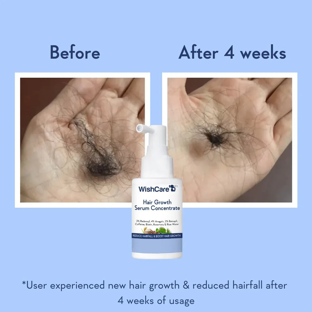 WishCare Hair Growth Serum Concentrate