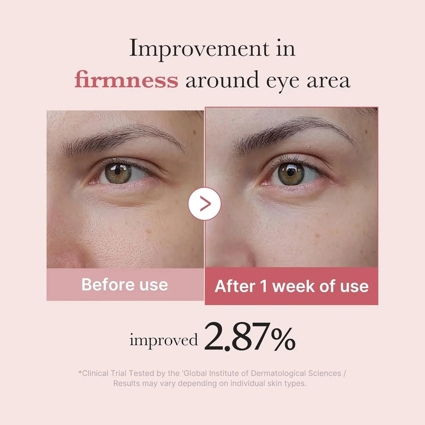 Medicube PDRN Pink Peptide Eye Cream 30ml - 30ml