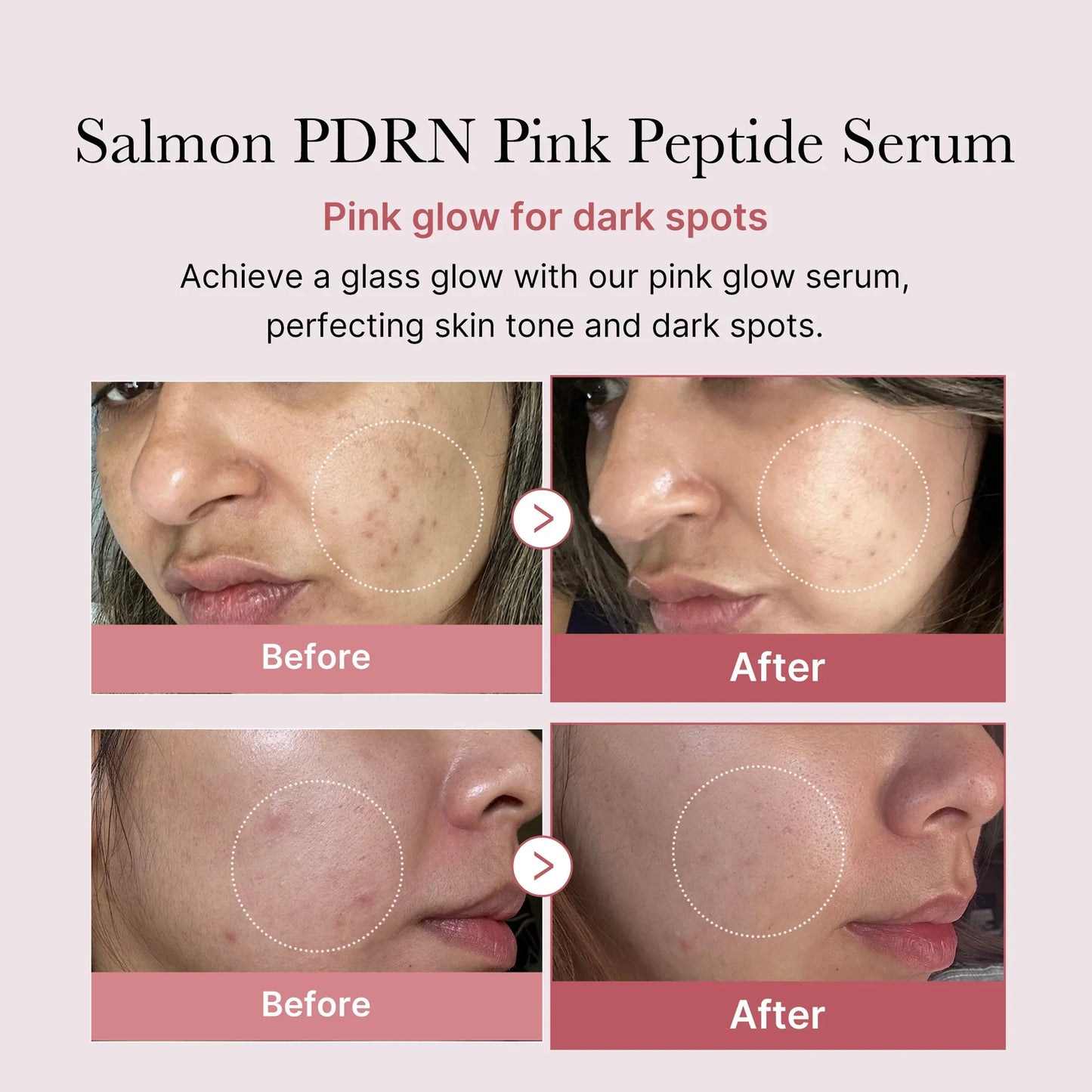 Medicube PDRN Pink Peptide Serum 30ml