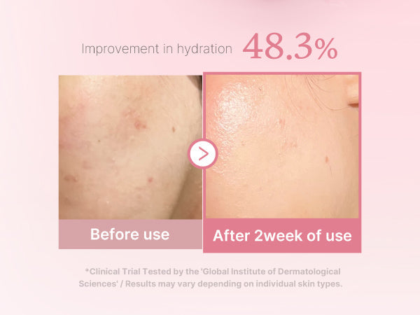 Medicube PDRN Pink Niacinamide Milky Toner 150ml