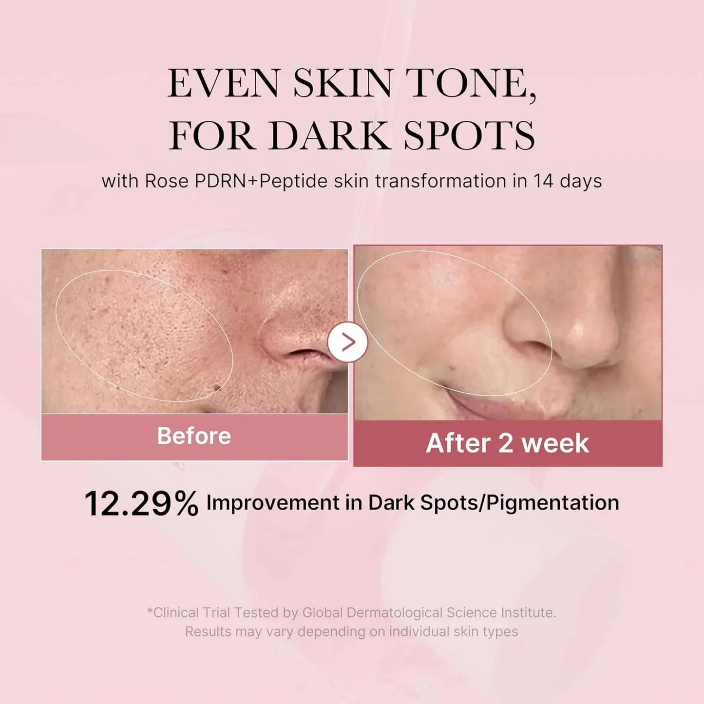 Medicube PDRN Pink Niacinamide Milky Toner 150ml