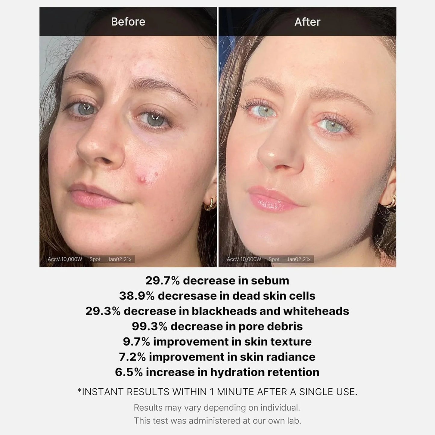 Medicube Red Acne Succinic Acid Peel | Peeling Serum 40g